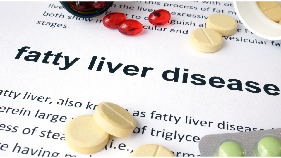 Steatotic Liver Disease: Symptoms, Risk Factors, and Prevention of Non-Alcoholic Fatty Liver