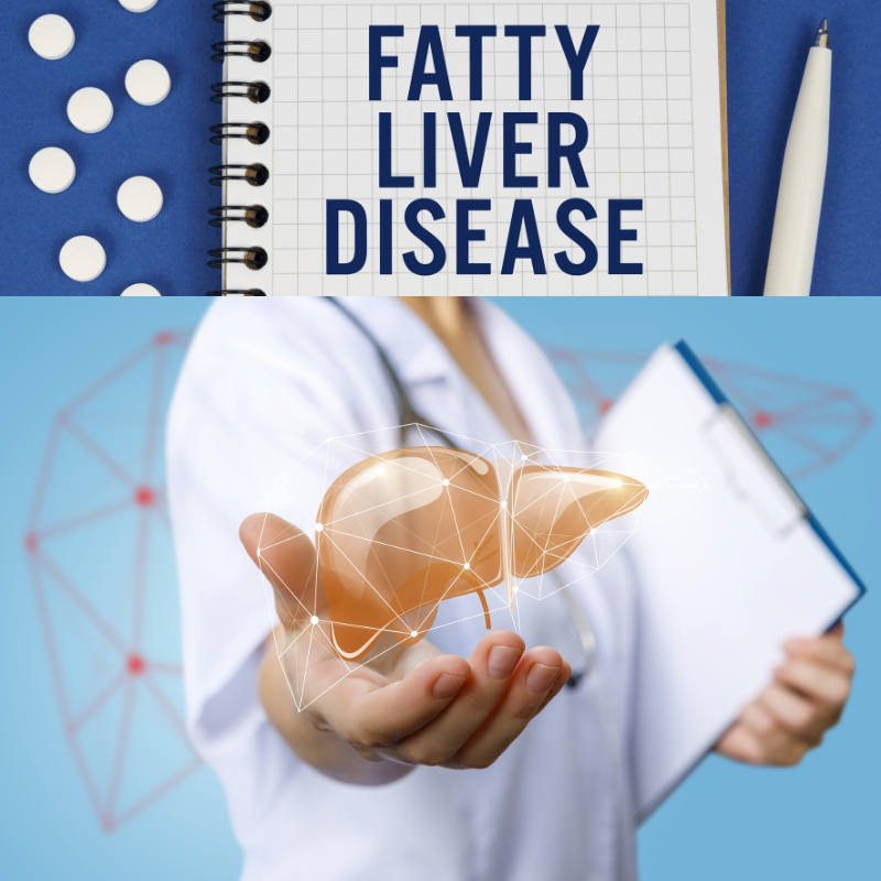 fatty liver disease