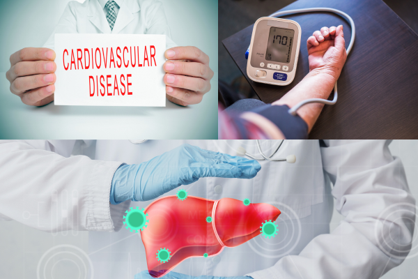 "Exploring the Triple Threat: NAFLD, Hypertension, and Cardiovascular Diseases Unraveled"