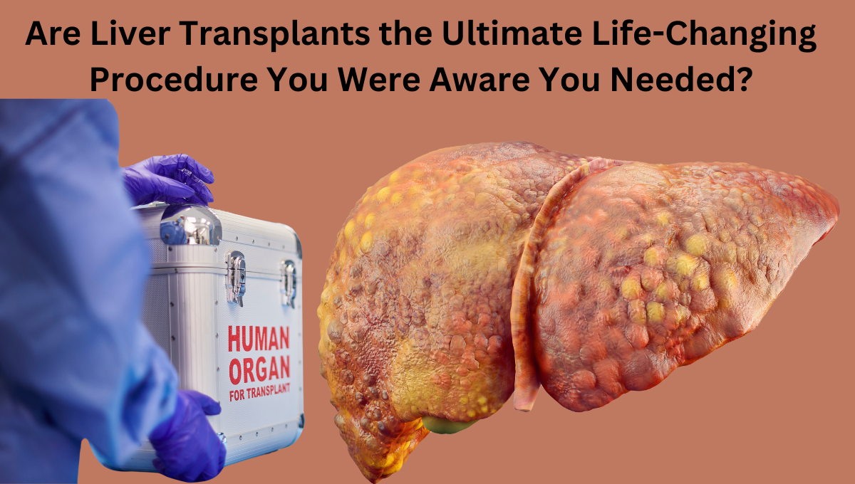 Are-Liver-Transplants-the-Ultimate-Life-Changing-Procedure-You-Were-Aware-You-Needed.