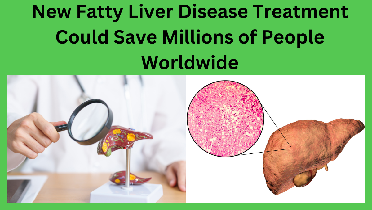 New Fatty Liver Disease Treatment Could Save Millions of People Worldwide.